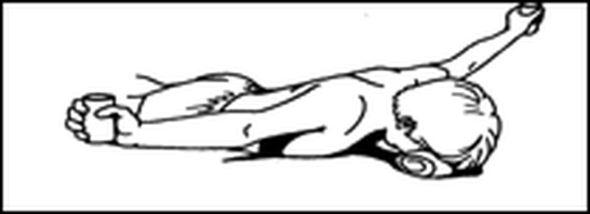 660x240 scoliosis roland jeffery physiotherapy