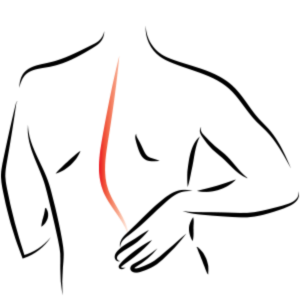 300x300 scoliosis kissun chiropractic