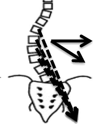 305x405 Depiction Of The Activation Of The Iliopsoas Muscle