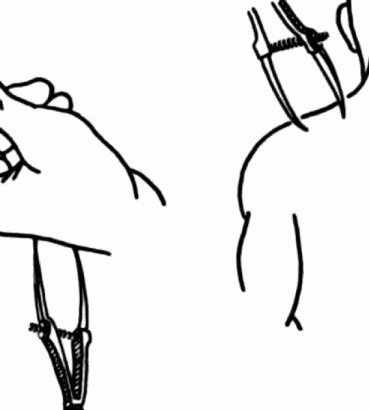 369x410 maybe you're too sensitive two point discrimination