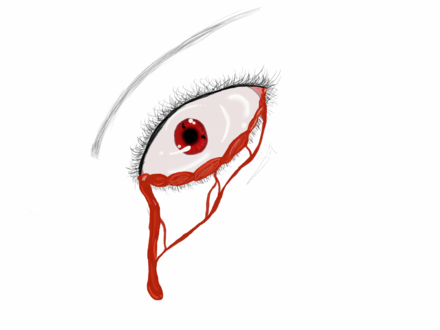 440x330 Bleeding Sharingan Eye