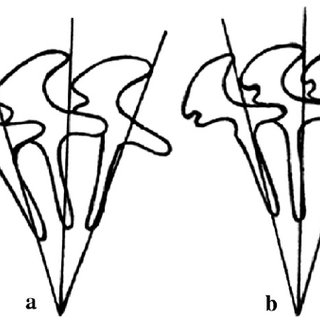 320x320 Diagrammatic Drawings Of Denticles Of Trichodina Heterodentata
