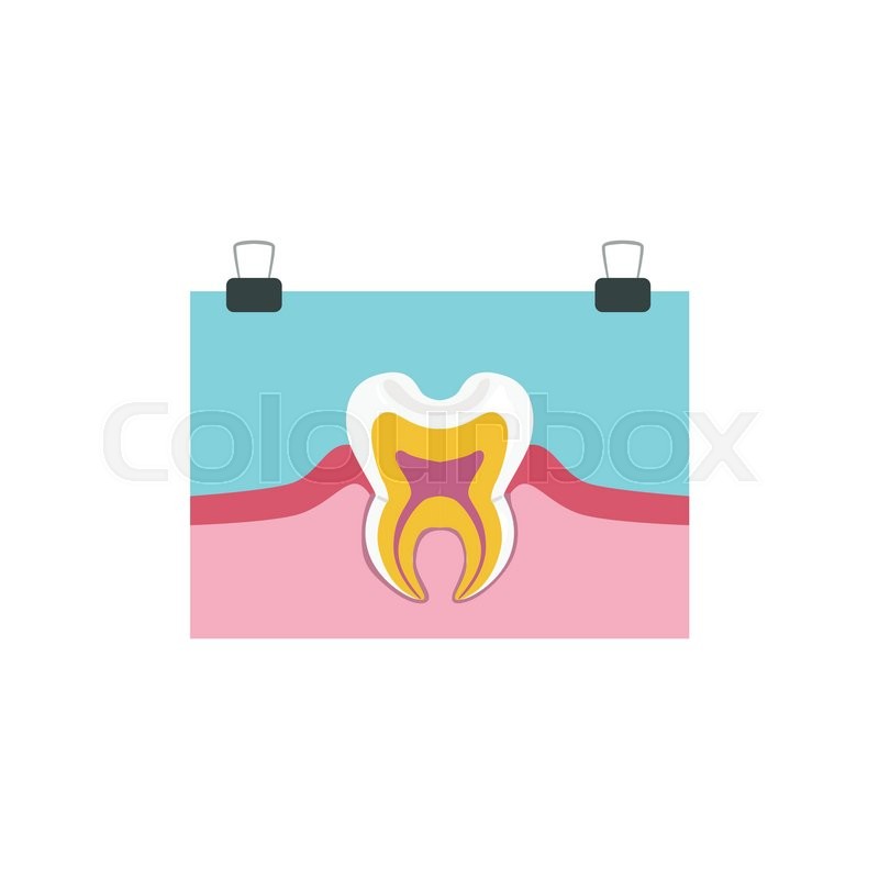 800x800 Tooth Anatomy Info Drawing Simple Stock Vector Colourbox
