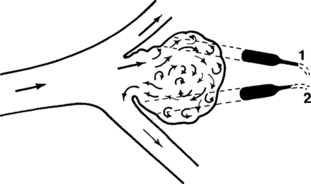 1024x607 intraoperative evaluation of cerebral hemodynamics using