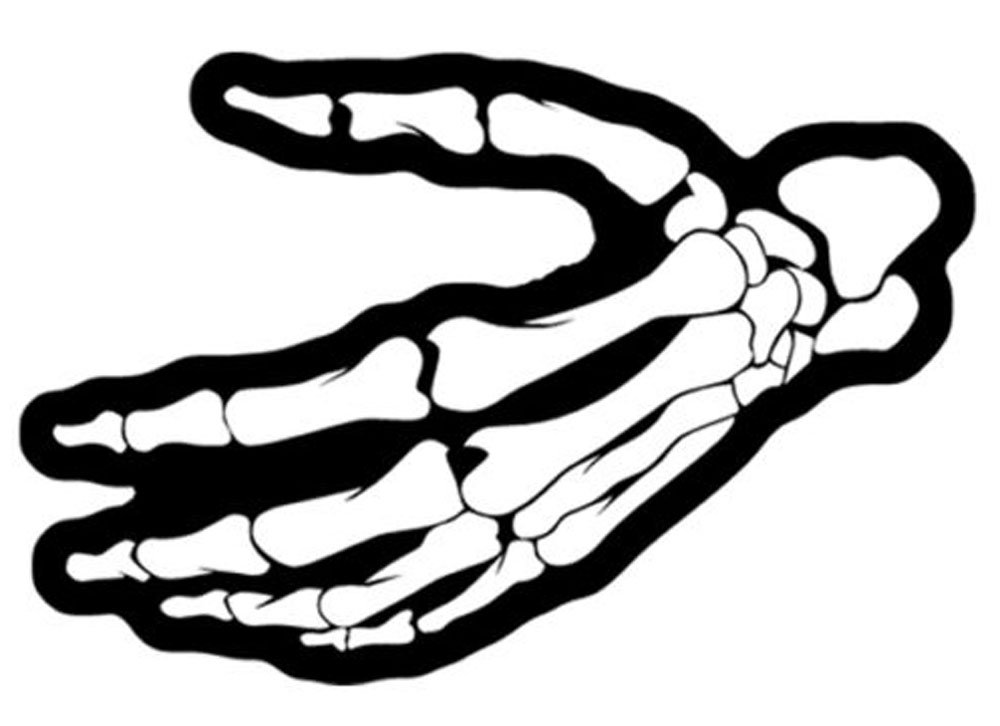 1000x726 Left Hand Of Skeleton Hand Bones