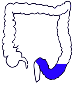 250x278 Sigmoid Colon