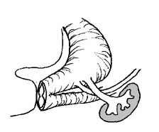 224x186 Normal Bladder Development