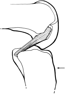 Smooth Muscle Drawing | Free download on ClipArtMag