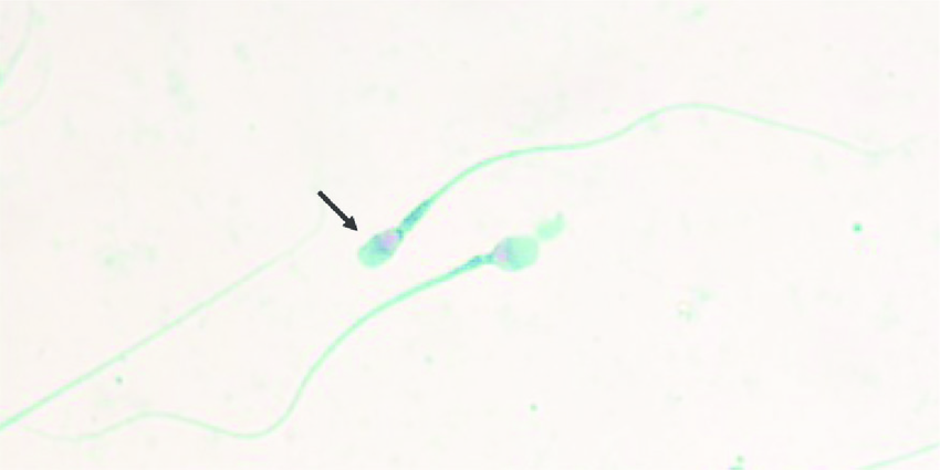 850x425 Profiles Of Sperm Production, Ejaculate Volume