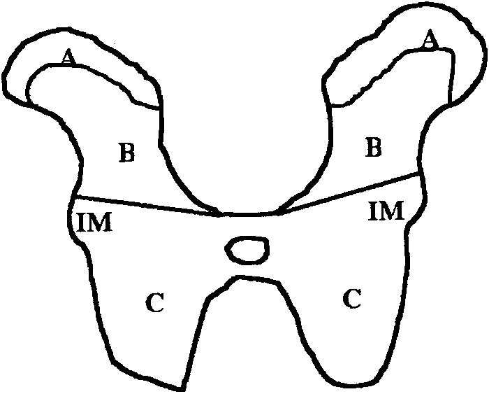 700x563 drawing of a hemisection of the spinal cord showing specific