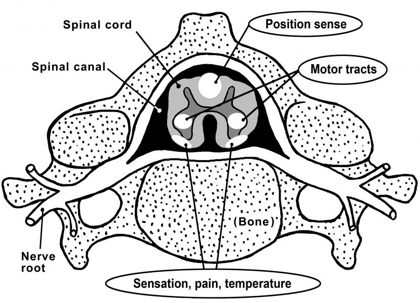 832x600 How Is The Spinal Cord Protected University Of Iowa Hospitals