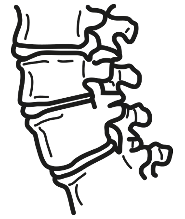 600x711 Drawing Spine