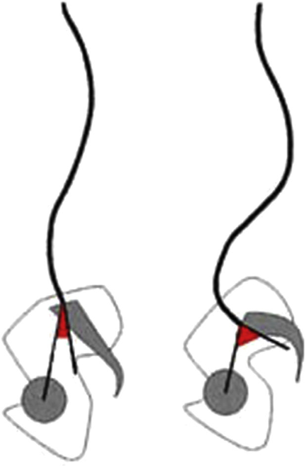 619x945 Schematic Drawing Of Two Extreme Sagittal Morphologies