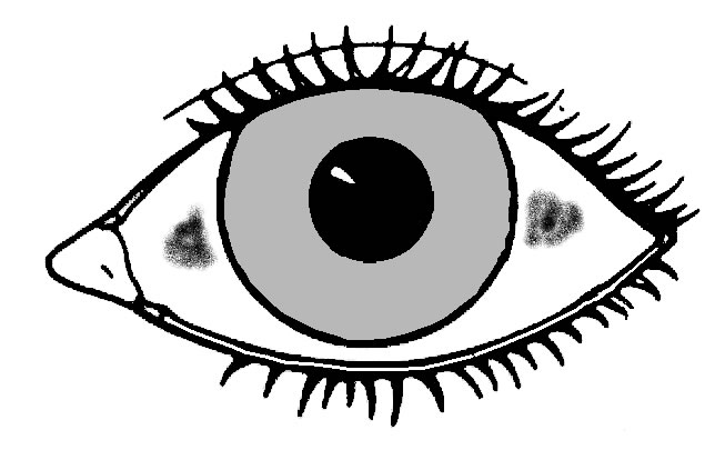 653x405 Bitot's Spots