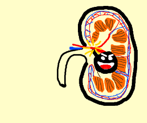 300x250 explosive kidney stain
