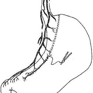 320x320 the two longitudinal rows of staples are secured with a continuous