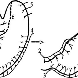 273x273 Stomach And The Formation Of Subtotal Gastric Tube