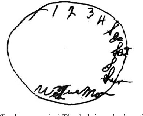 468x380 The Test Of Time A History Of Clock Drawing