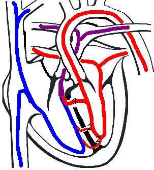 303x334 A Pikler Experience Not A Textbook Situation