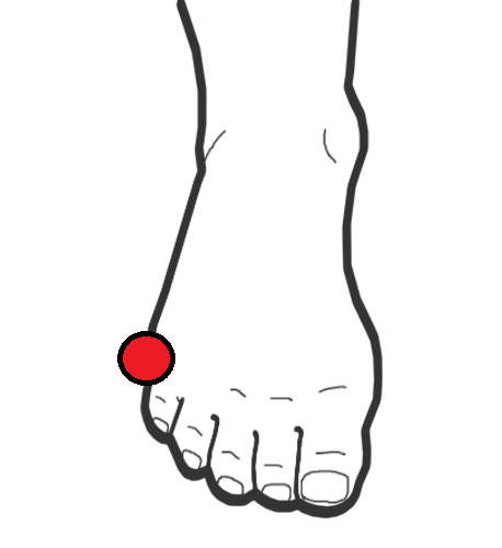 458x500 Pain On Pinky Toe Joint From Cleat Setup