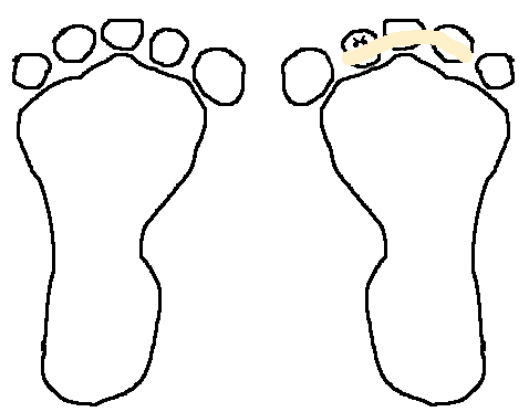 478x373 Yeah Good Times Stupid Toe