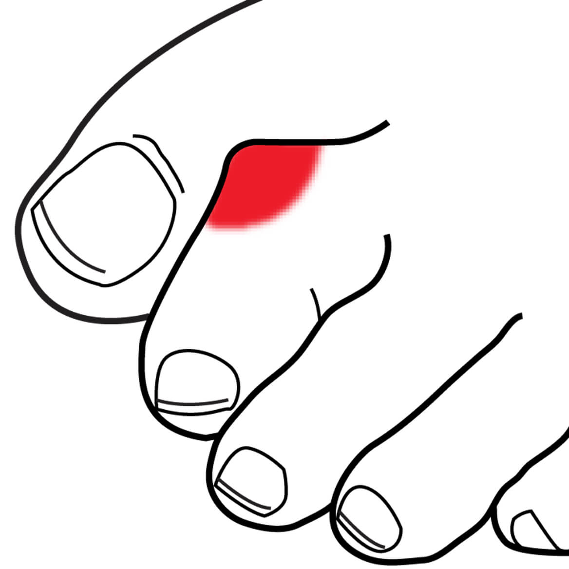 1168x1168 Gel Bunion Toe Wrap