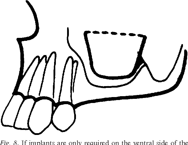 636x490 Figure From Treatment Rationale Anatomical Aspects Of Sinus