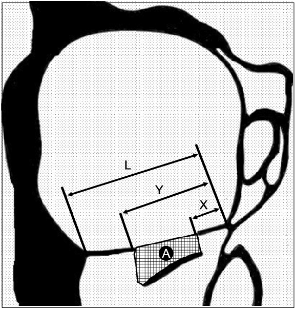 576x603 schematic drawing of right orbit the distances