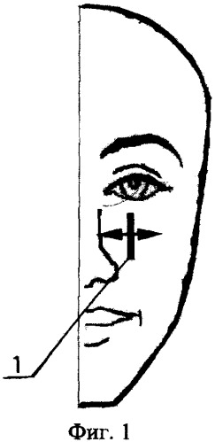 243x499 method of ultrasound examination of paranasal sinus diseases