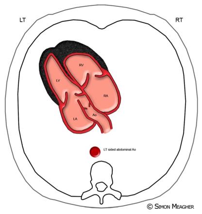 416x442 fetal echocardiography views radiology reference article