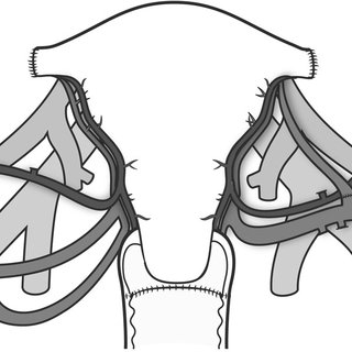 320x320 schematic drawing of vascular connections in human uterus