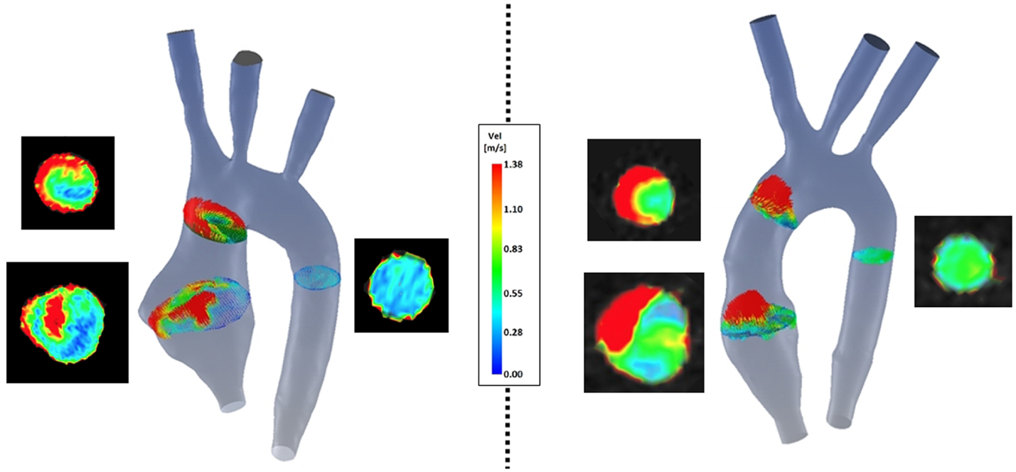 1429x664 frontiers using cardiovascular magnetic resonance imaging