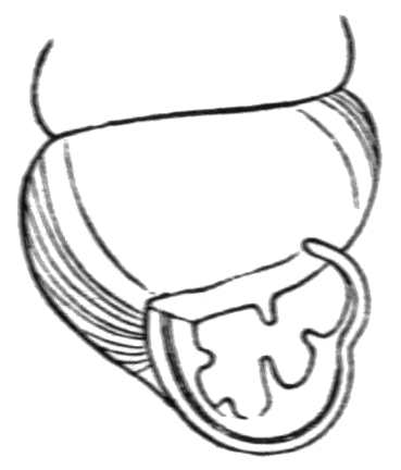 369x432 Vertigo Ventricosa