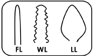374x223 Schematic Drawing Of Villus Types Finger Like