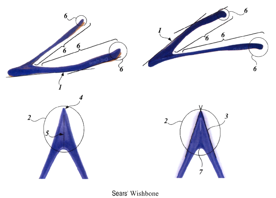 937x672 is your turkey wishbone protected