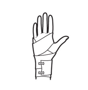 300x309 How To Treat A Sprained Wrist