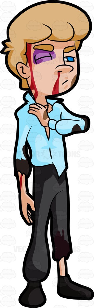 315x1024 Black Eye Clipart