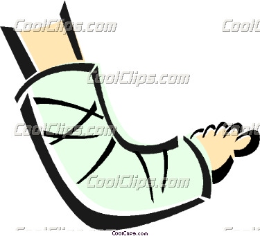 375x341 Body Cast Clipart