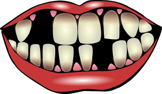 640x374 Decay Clipart Bad Tooth