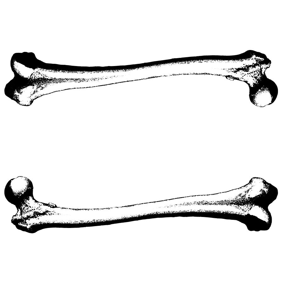 Bone Image
