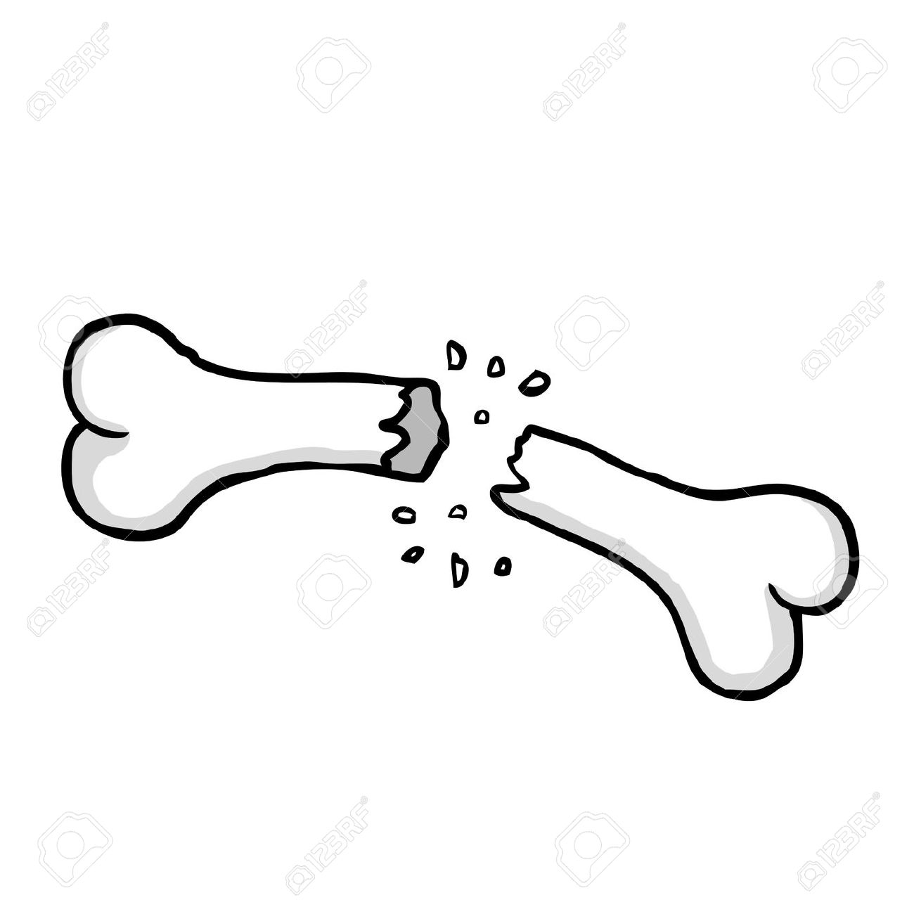 1300x1300 Broken Bone Clipart