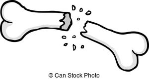 300x160 Bones Clipart Broken Bone
