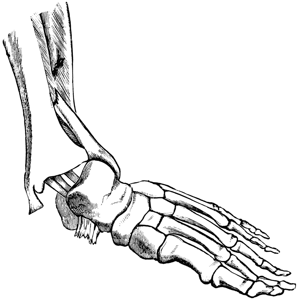 1022x1024 Fractured Fibula Clipart Etc