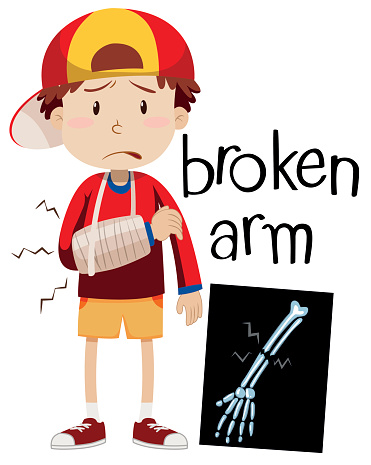 371x465 Broken Arm Clipart Many Interesting Cliparts