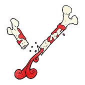 170x170 Broken Bone Clip Art