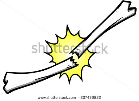450x326 Broken Bone Clipart