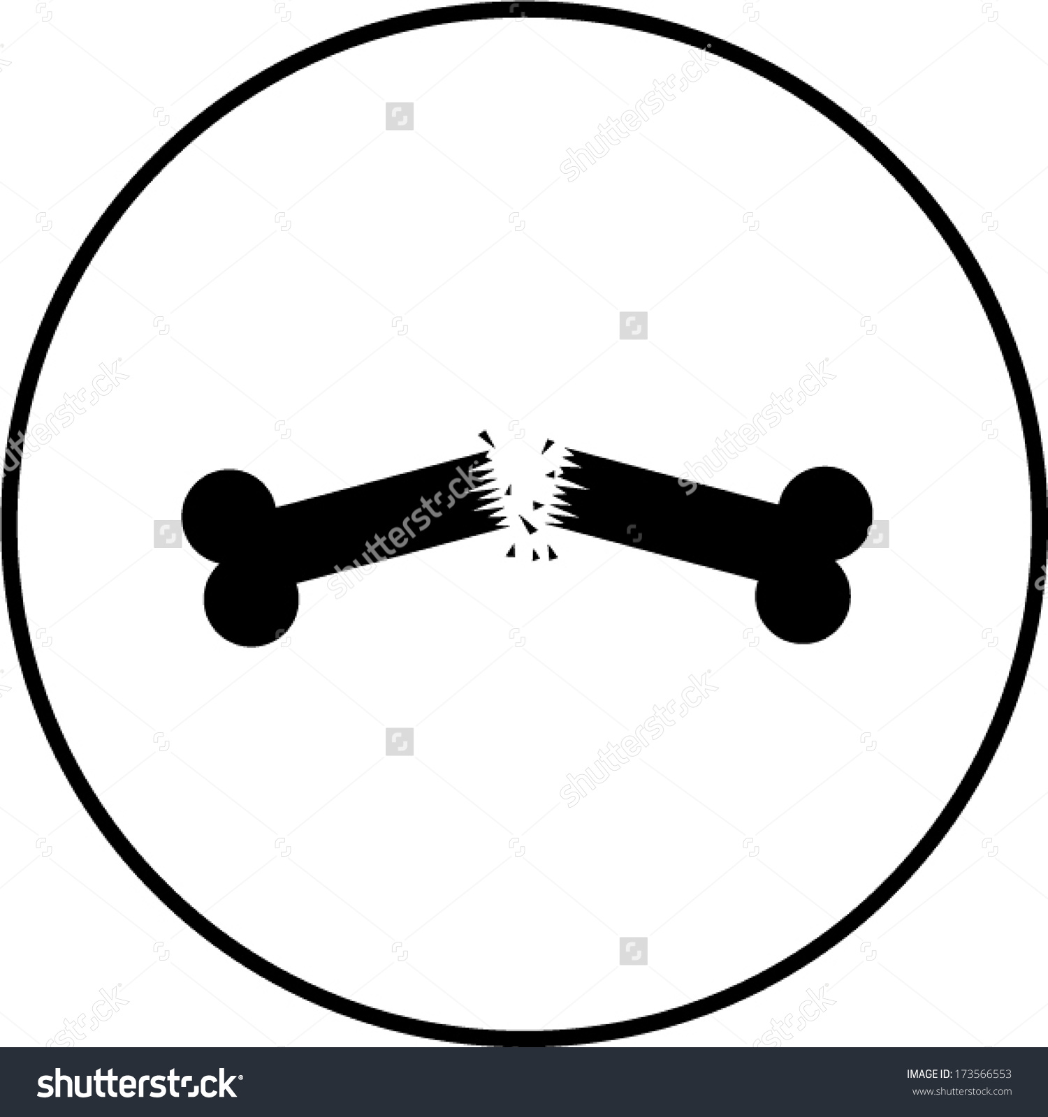 1500x1600 Broken Bone Clip Art Clipart Collection