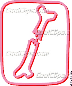 249x300 Broken Bone Vector Clip Art
