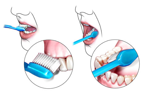 460x300 How To Brush Your Teeth