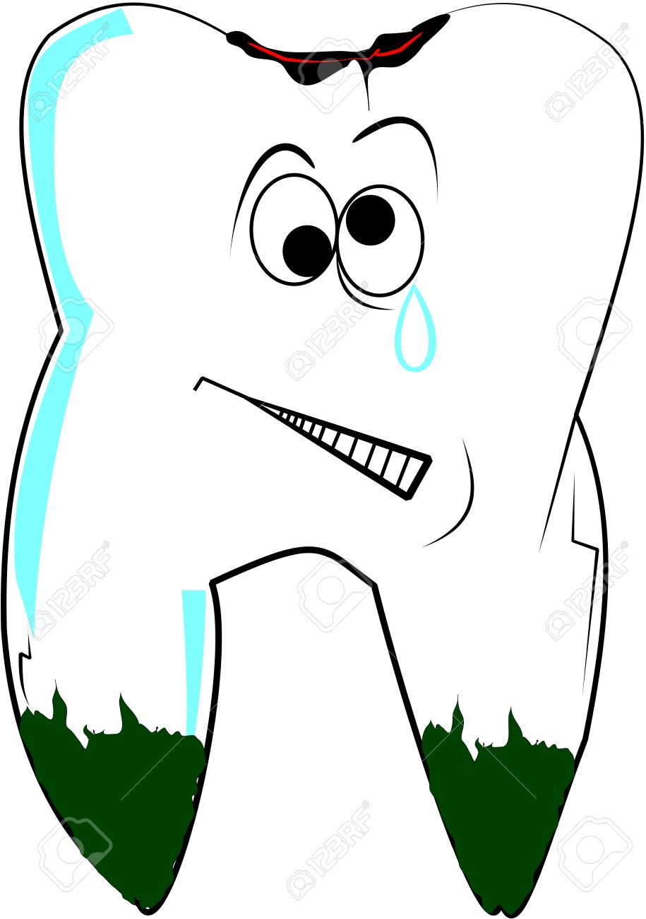 915x1300 Decay Clipart Tooth Pain